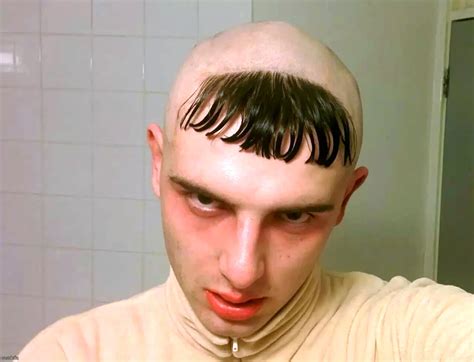 Лысый