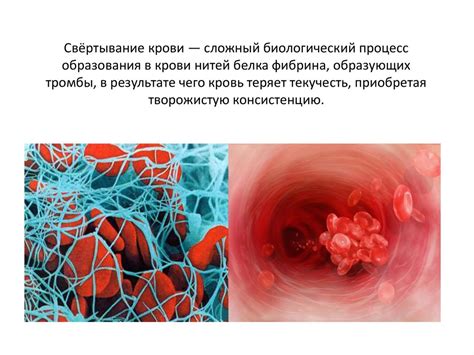 Причины образования нитей