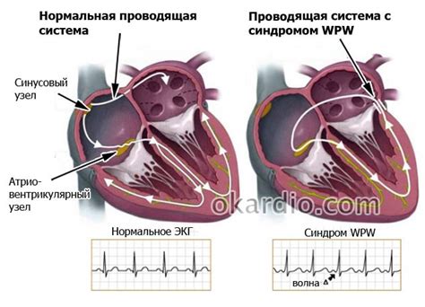 Причины развития ВПВ и его основные симптомы