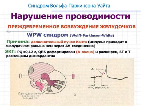 Синдром ВПВ и опасные препараты
